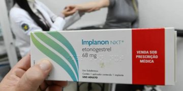 Alex Redano solicita 350 implantes contraceptivos para mulheres de Alvorada